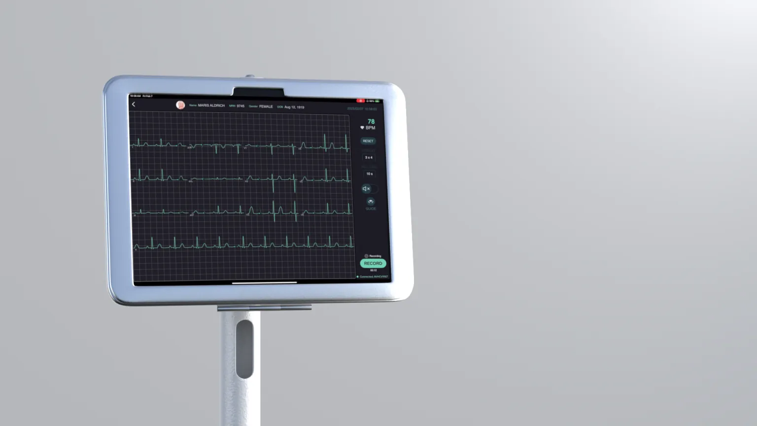 12-lead EKG tracing displayed on the EKGx tablet